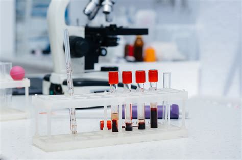 lab test package|blood test packages near me.